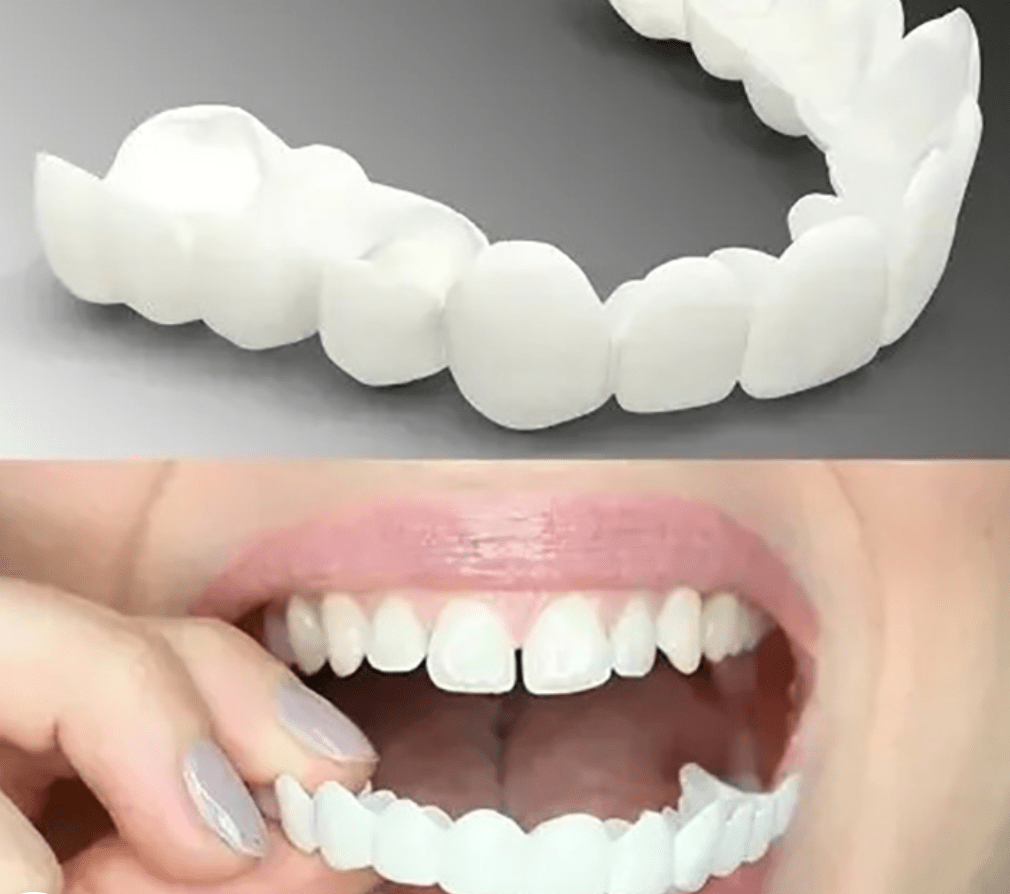 Adjustable Snap-On Dentures - Coldesk