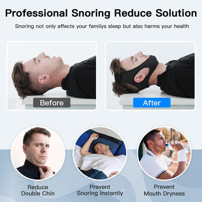 Anti Snoring Chin Strap for Sleep Apnea - Coldesk