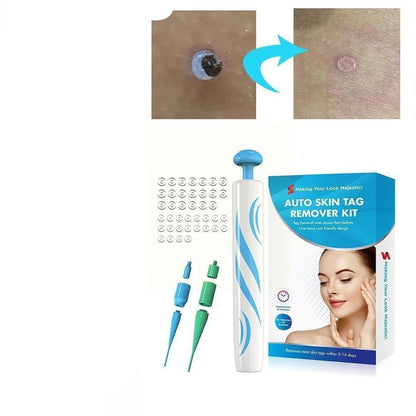 Auto Skin Tag Remover Painless - Coldesk
