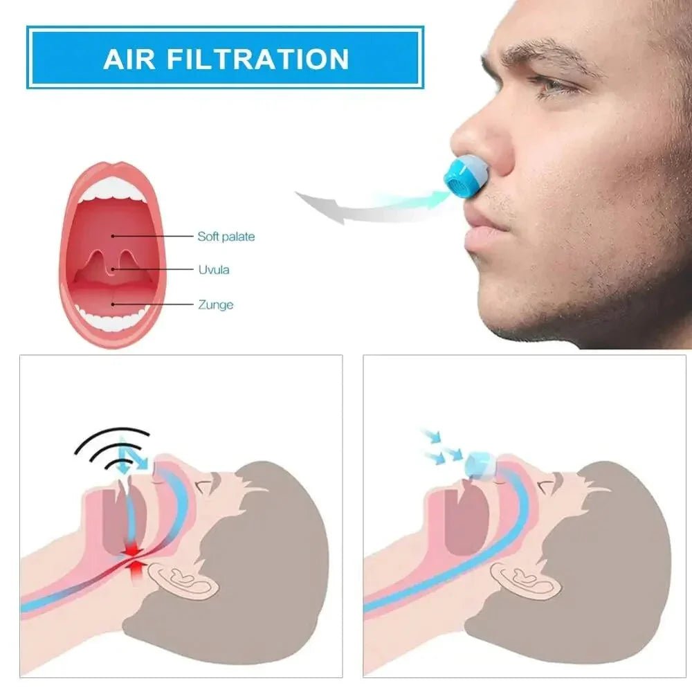 Micro CPAP Sleep Apnea Machine For Travel & Anti Snoring – CPAP Alternative - Coldesk