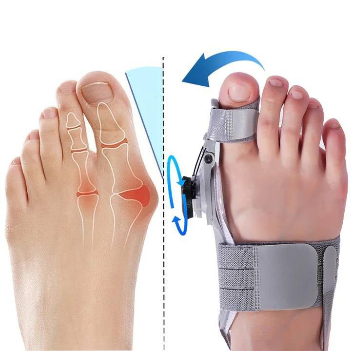 Natural Bunions Corrector Toe Spacer - Coldesk