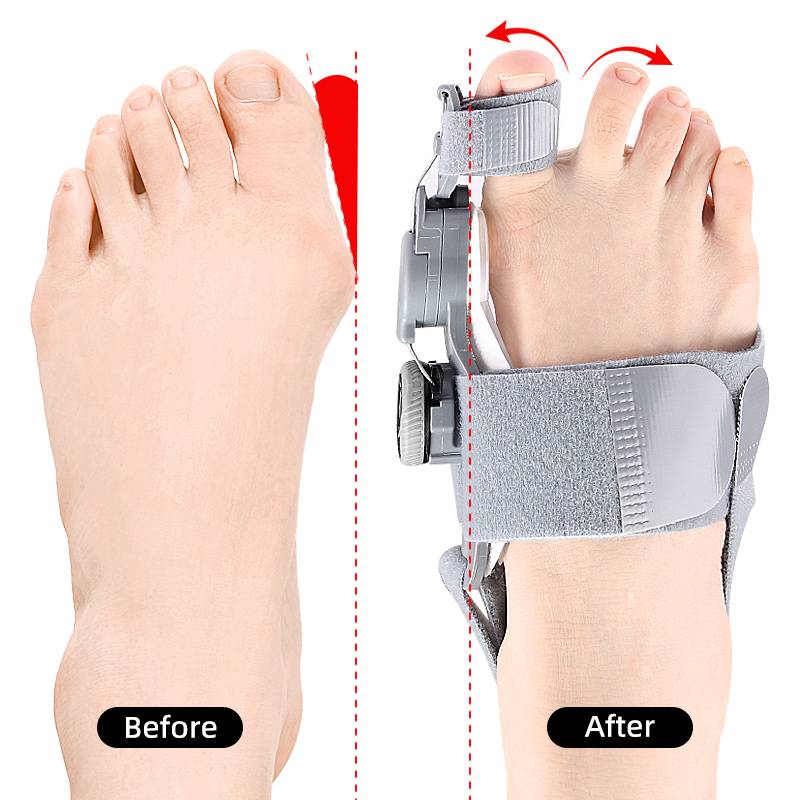 Natural Bunions Corrector Toe Spacer - Coldesk