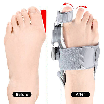Natural Bunions Corrector Toe Spacer - Coldesk