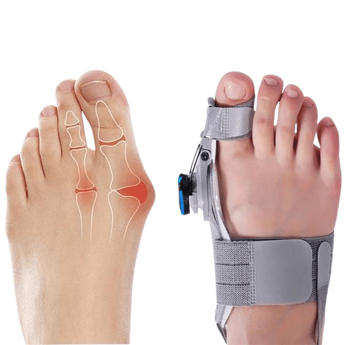 Natural Bunions Corrector Toe Spacer - Coldesk