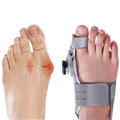 Natural Bunions Corrector Toe Spacer - Coldesk
