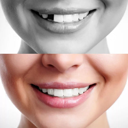 Original Moldable False Teeth - Coldesk