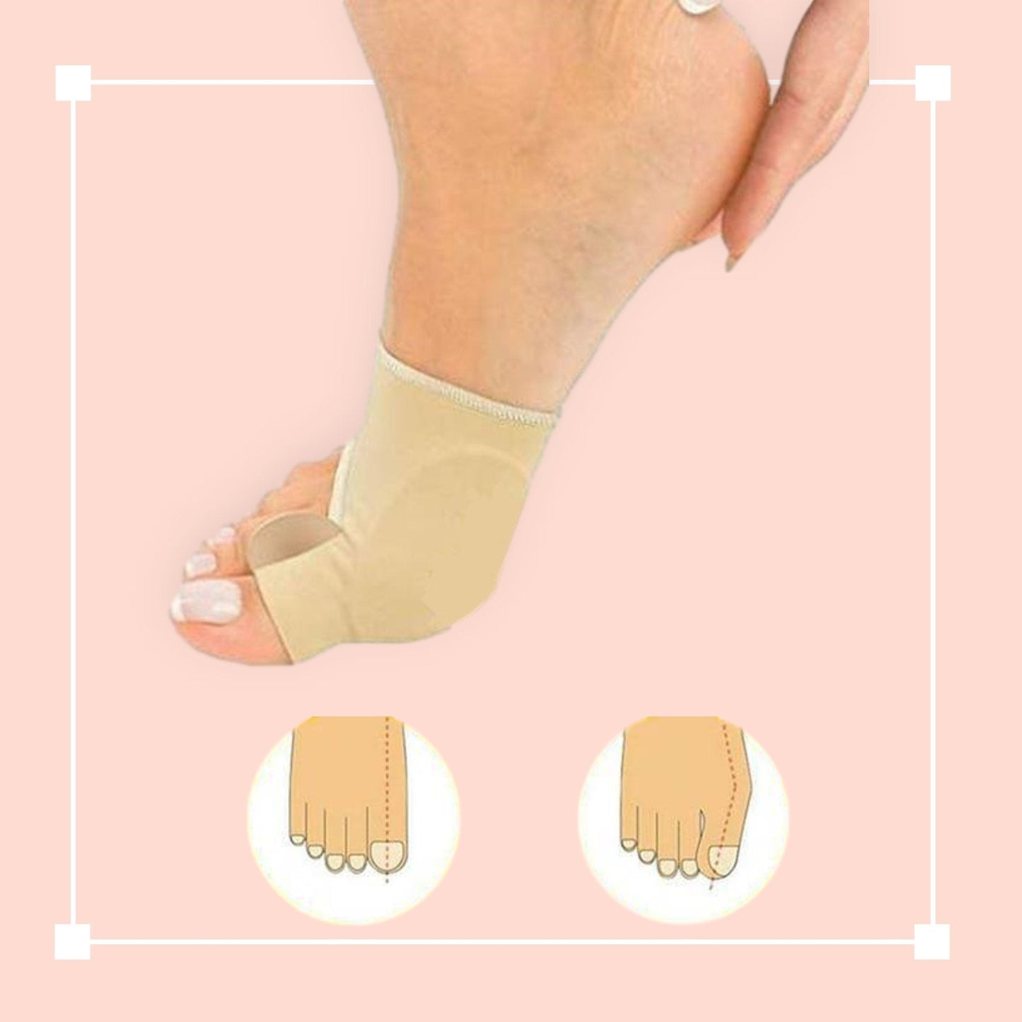 Orthopedic Toe Bunion Corrector - Coldesk