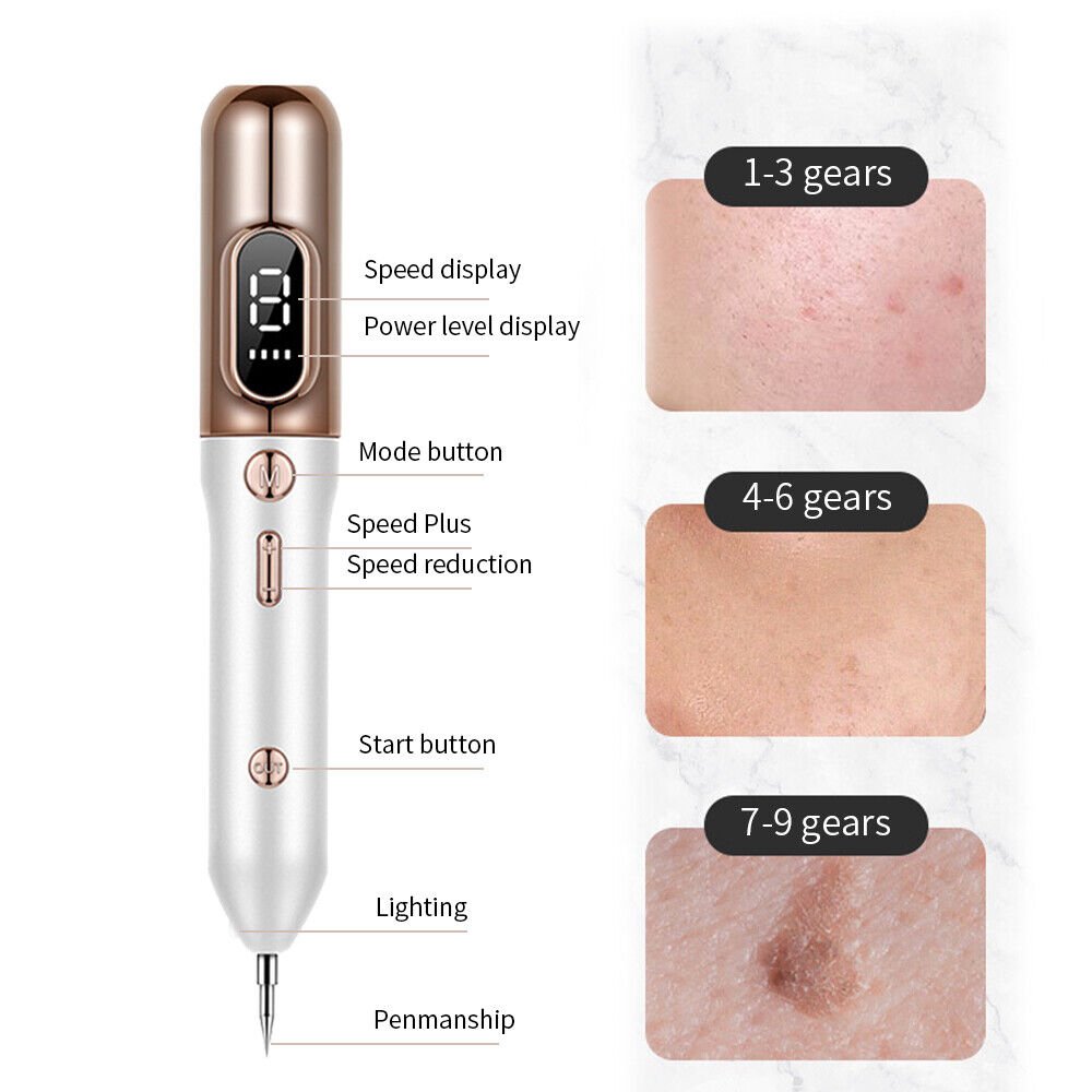 Plasma Pen To Remove Skin Tags, Moles And Warns - Coldesk