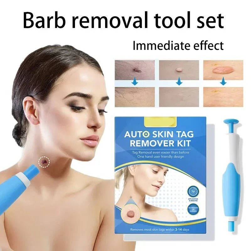 Skin Tag Removal Kit - Coldesk
