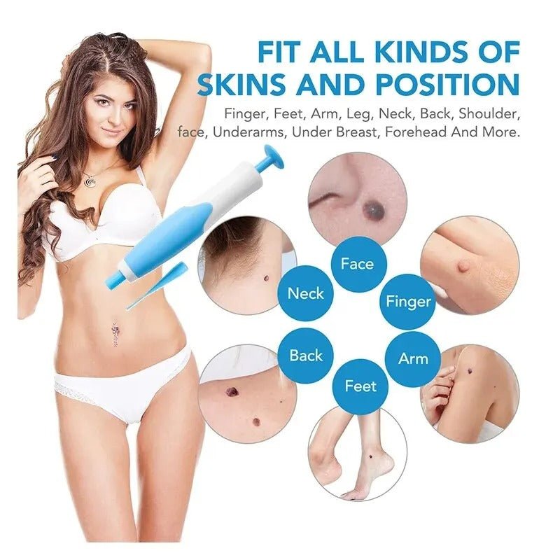 Skin Tag Removal Kit - Coldesk