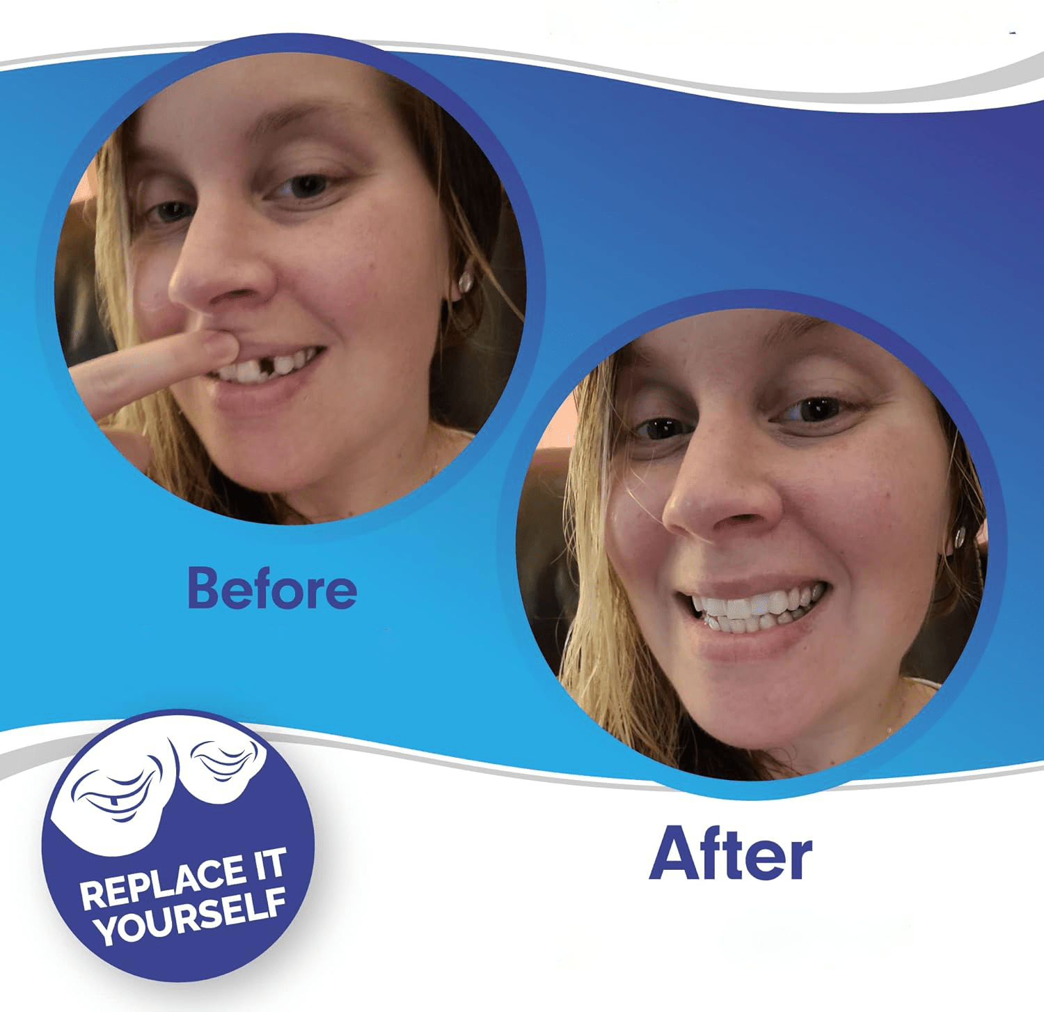 Smile Veneer (Upper & Lower Included) - Coldesk