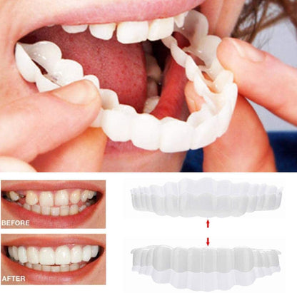 Smile Veneer (Upper & Lower Included) - Coldesk