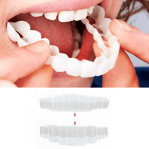 Smile Veneer (Upper & Lower Included) - Coldesk