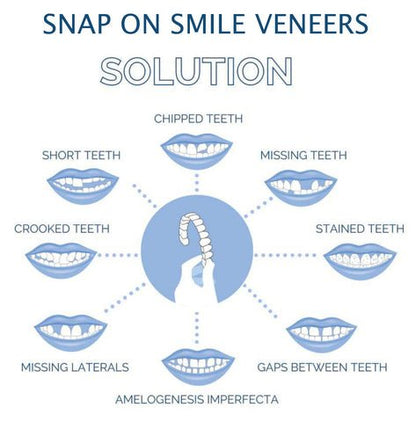 Smile Veneer (Upper & Lower Included) - Coldesk