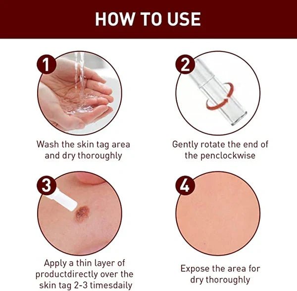 Tags & Moles Remover - Coldesk