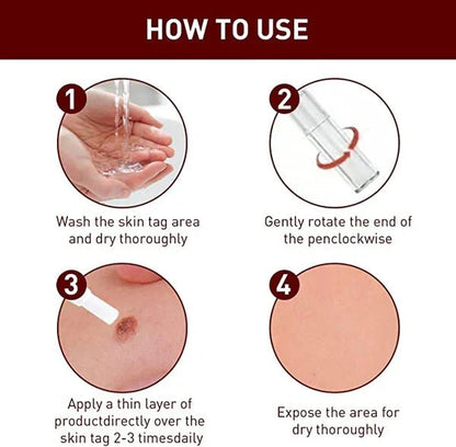 Tags & Moles Remover - Coldesk