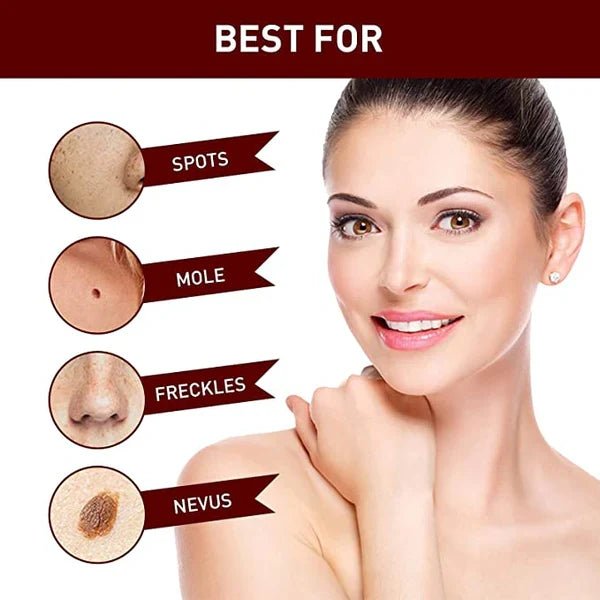 Tags & Moles Remover - Coldesk